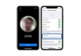 Sửa Face ID iPhone Xs